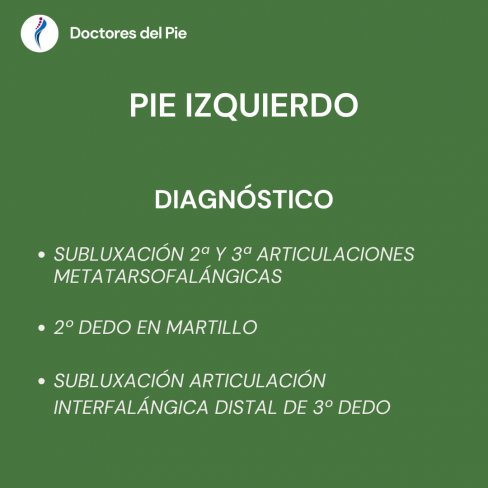 2º DEDO EN MARTILLO - REVISIÓN 1 AÑO